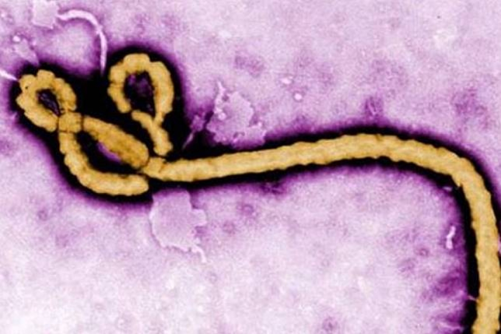 剛果民主共和國，伊波拉病毒感染疫情再度爆發！即日起我國提升剛果旅遊疫情建議等級至第二級警示（Alert）。（圖片取自CDC）