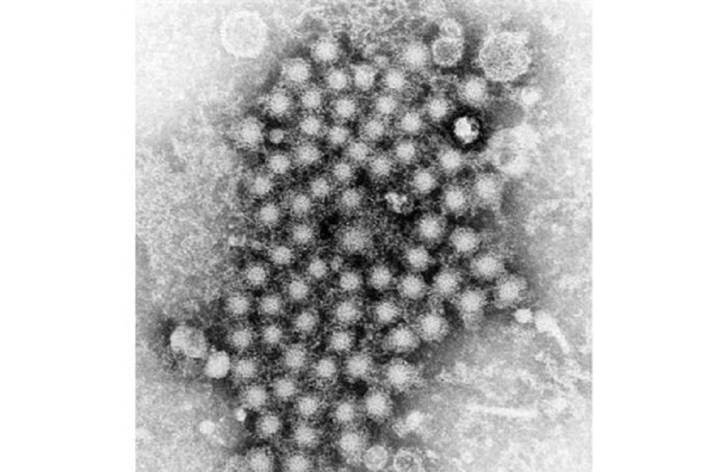C型肝炎最常見的傳染途徑為受污染的血液感染。圖為C型肝炎病毒。（翻攝網路）