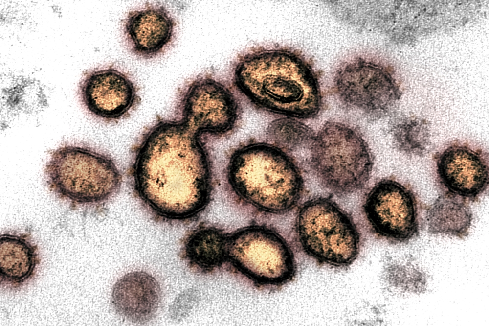 澳洲科學家發現用作殺死寄生蟲的伊維菌素，能有效殺死新型冠狀病毒，圖為在顯微鏡下的冠狀病毒。（湯森路透）